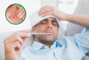 Dengue Fever Treatment: Ayurvedic & Home Remedies